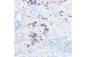 Immunohistochemistry (IHC) image for anti-Runt-Related Transcription Factor 2 (RUNX2) (AA 242-521) antibody (ABIN3016834)