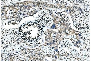 IHC analysis of Calponin 2/CNN2 using anti-Calponin 2/CNN2 antibody (ABIN7602856).