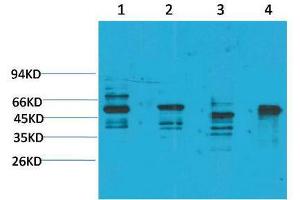 Western Blot (WB) analysis of 1) Rat Brain Tissue, 2)Mouse Brain Tissue, 3) K562, 4) HepG2 with KCNN4(SK4) Rabbit Polyclonal Antibody diluted at 1:2000. (KCNN4 Antikörper)