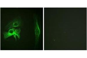 Immunofluorescence analysis of HeLa cells, using PAK1 (Ab-212) Antibody. (PAK1 Antikörper  (AA 178-227))