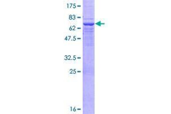 UEVLD Protein (AA 1-357) (GST tag)