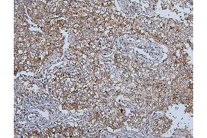 IHC analysis of HSPH1 using anti-HSPH1 antibody (ABIN7602237). (HSPH1 Antikörper  (AA 653-858))