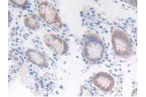 IHC-P analysis of Human Stomach Tissue, with DAB staining. (FGFRL1 Antikörper  (AA 168-378))