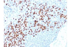 Immunohistochemistry (IHC) image for anti-Matrix Metallopeptidase 9 (Gelatinase B, 92kDa Gelatinase, 92kDa Type IV Collagenase) (MMP9) antibody (ABIN6940075)