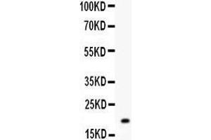 Anti- MGMT Picoband antibody, Western blotting All lanes: Anti MGMT  at 0. (MGMT Antikörper  (AA 2-207))