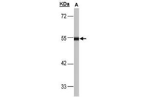 WB Image Sample(30 μg of whole cell lysate) A:293T 10% SDS PAGE antibody diluted at 1:1000 (DLD Antikörper)