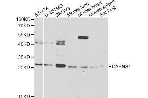 Western blot analysis of extracts of various cell lines, using CAPNS1 Antibody. (Calpain S1 Antikörper  (AA 69-268))