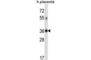 Western Blotting (WB) image for anti-Dehydrogenase/reductase (SDR Family) Member 7C (DHRS7C) antibody (ABIN2997541) (DHRS7C Antikörper)