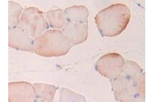 Detection of PFKP in Rat Skeletal muscle Tissue using Polyclonal Antibody to Phosphofructokinase, Platelet (PFKP) (PFKP Antikörper  (AA 354-570))
