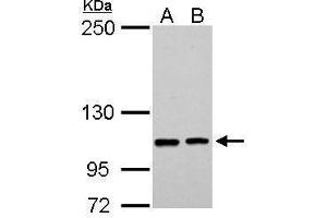 WB Image EPB41L3 antibody [C3], C-term detects EPB41L3 protein by Western blot analysis. (EPB41L3 Antikörper  (C-Term))