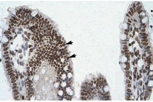 Human Intestine (POU6F1 Antikörper  (Middle Region))