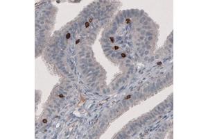 Immunohistochemical staining (Formalin-fixed paraffin-embedded sections) of human fallopian tube with CD8A monoclonal antibody, clone CL1529  shows strong positivity in a subset of lymphoid cells. (CD8 alpha Antikörper  (AA 64-147))