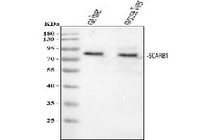 Western blot analysis of SCARB1 using anti-SCARB1 antibody (ABIN3043322).