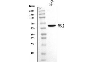 Western blot analysis of MSL2 using anti-MSL2 antibody (ABIN7599488).