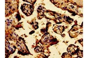 Immunohistochemistry of paraffin-embedded human placenta tissue using ABIN7172906 at dilution of 1:100 (TPT1 Antikörper  (AA 1-172))