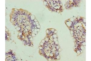 Immunohistochemistry of paraffin-embedded human small intestine tissue using ABIN7168606 at dilution of 1:100 (SCARA3 Antikörper  (AA 201-466))