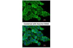 ICC/IF Image Immunofluorescence analysis of paraformaldehyde-fixed mouse ESC D3, using alpha Actin (smooth muscle), antibody at 1:200 dilution. (Smooth Muscle Actin Antikörper  (N-Term))