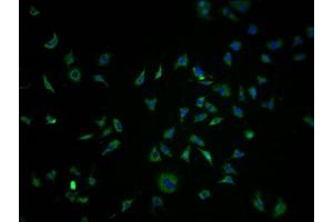 Immunofluorescence staining of SH-SY5Y cells with ABIN7139960 at 1:100, counter-stained with DAPI. (OR1K1 Antikörper  (AA 259-272))