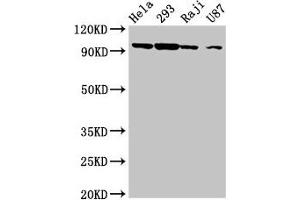 Western Blot Positive WB detected in: Hela whole cell lysate, 293 whole cell lysate, Raji whole cell lysate, U87 whole cell lysate All lanes: MASTL antibody at 6. (MASTL Antikörper  (AA 612-740))