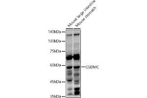 Western blot analysis of extracts of various cell lines, using GSDMC antibody (ABIN7268463) at 1:1000 dilution. (MLZE Antikörper  (AA 1-100))