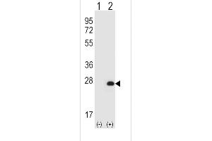 Western blot analysis of HPRT1 (arrow) using rabbit polyclonal HPRT1 Antibody (N-term) (ABIN652234 and ABIN2840981). (HPRT1 Antikörper  (N-Term))