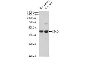 Western blot analysis of extracts of various cell lines, using CSAD antibody (ABIN6133497, ABIN6139087, ABIN6139088 and ABIN6217983) at 1:5000 dilution. (CSAD Antikörper  (AA 371-520))