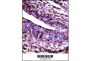 Immunohistochemistry (IHC) image for anti-Adrenergic, Beta, Receptor Kinase 2 (ADRBK2) (AA 524-552), (C-Term) antibody (ABIN5530602)