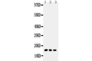 Western Blotting (WB) image for anti-Caveolin 2 (CAV2) (AA 1-17), (N-Term) antibody (ABIN3042683) (Caveolin 2 Antikörper  (N-Term))