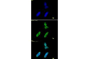 Histone H3 acetyl Lys9 antibody tested by immunofluorescence.
