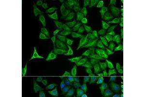 Immunofluorescence analysis of HeLa cells using KRT20 Polyclonal Antibody (KRT20 Antikörper)