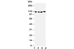 Western blot testing of SERCA2 ATPase antibody and Lane 1:  rat skeletal muscle (SERCA2 ATPase (Middle Region) Antikörper)