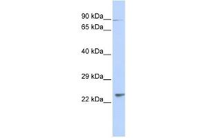 LRRC51 antibody used at 1 ug/ml to detect target protein. (Leucine Rich Transmembrane and 0-Methyltransferase Domain Containing (LRTOMT) (N-Term) Antikörper)