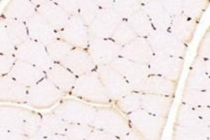 Immunohistochemistry (Paraffin-embedded Sections) (IHC (p)) image for anti-T-Box 10 (TBX10) antibody (ABIN7075814)
