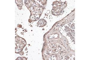 Immunohistochemistry of paraffin-embedded human placenta using MEF2C antibody (ABIN6132345, ABIN6143716, ABIN6143717 and ABIN6215998) at dilution of 1:100 (40x lens). (MEF2C Antikörper  (AA 170-380))