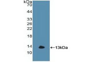 Western blot analysis of recombinant Human GbA. (GBA Antikörper  (AA 117-214))