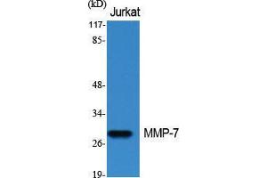 Western Blot (WB) analysis of specific cells using MMP-7 Polyclonal Antibody. (MMP7 Antikörper  (C-Term))