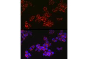 Immunofluorescence analysis of HepG2 cells using  Rabbit mAb (ABIN7265367) at dilution of 1:100 (40x lens). (ACAA2 Antikörper)