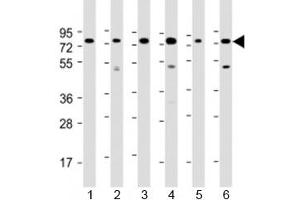Western blot testing of human 1) Daudi, 2) HepG2, 3) Jurkat, 4) K562, 5) MOLT-4 and 5) Raji cell lysate with PABPC3 antibody at 1:2000. (PABPC3 Antikörper  (AA 84-117))