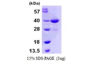 SDS-PAGE (SDS) image for Mitogen-Activated Protein Kinase Kinase 3 (MAP2K3) (AA 1-318) protein (His tag) (ABIN667410)