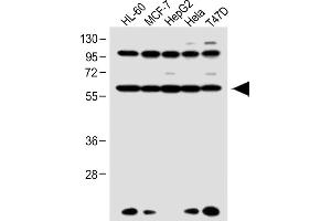 All lanes : Anti-RARA Antibody (C-term) at 1:1000 dilution Lane 1: HL-60 whole cell lysate Lane 2: MCF-7 whole cell lysate Lane 3: HepG2 whole cell lysate Lane 4: Hela whole cell lysate Lane 5: T47D whole cell lysate Lysates/proteins at 20 μg per lane. (Retinoic Acid Receptor alpha Antikörper  (C-Term))