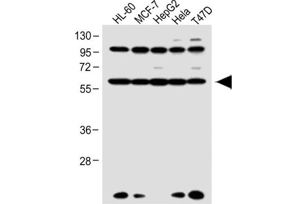 Retinoic Acid Receptor alpha Antikörper  (C-Term)