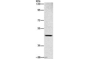 Western blot analysis of Human placenta tissue, using SIGLEC6 Polyclonal Antibody at dilution of 1:1000 (SIGLEC6 Antikörper)