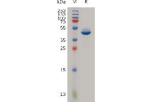 SDS-PAGE (SDS) image for Neurotensin (NTS) (AA 24-148) protein (Fc Tag) (ABIN7491109)