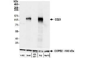 Western Blotting (WB) image for anti-Complement Component (3d/Epstein Barr Virus) Receptor 2 (CR2) (C-Term) antibody (ABIN7795815) (Rekombinanter CD21 Antikörper  (C-Term))