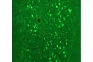 Immunofluorescence Microscopy of Anti-Calretinin (Sheep) Antibody Immunofluorescence Microscopy of Anti-Calretinin (Sheep) Antibody. (Calretinin Antikörper)