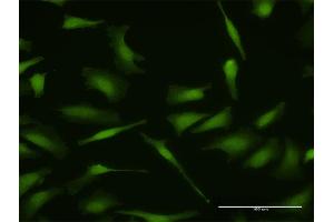Immunofluorescence of purified MaxPab antibody to MDM4 on HeLa cell. (MDM4-binding Protein Antikörper  (AA 1-490))