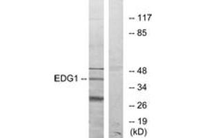 Western blot analysis of extracts from COLO205 cells, using EDG1 Antibody. (S1PR1 Antikörper  (AA 5-54))
