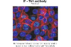Image no. 1 for anti-Transglutaminase 1, Keratinocyte (TGM1) antibody (ABIN347015) (TGM1 Antikörper)