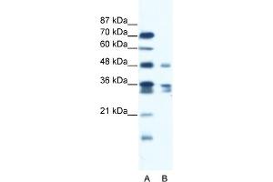 WB Suggested Anti-ZNF577 Antibody Titration:  1. (ZNF577 Antikörper  (C-Term))