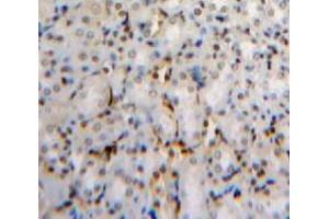 Used in DAB staining on fromalin fixed paraffin-embedded Kidney tissue (PHAP1 Antikörper  (AA 2-175))